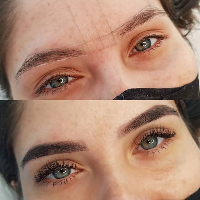 Antes e depois